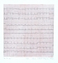 Ekg, 2008