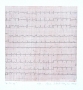 Ekg, 2008 r.